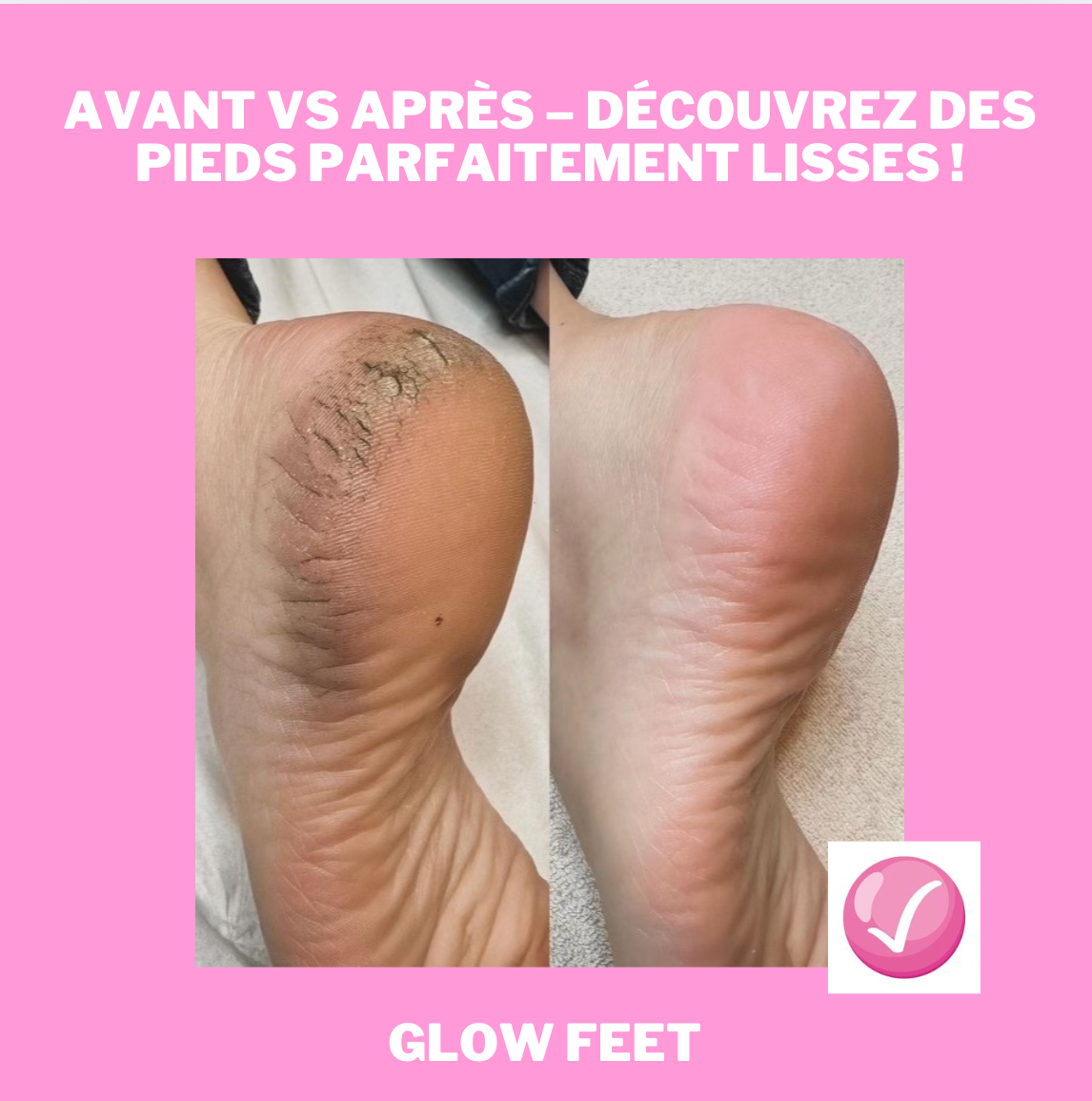 Lime Électrique pour Pieds – Machine de Pédicure Anti-Callosités et Peaux Mortes